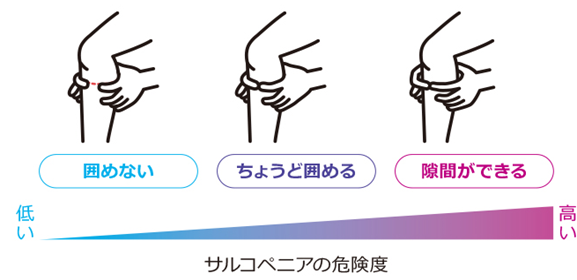 サルコペニアの危険度チェックの画像